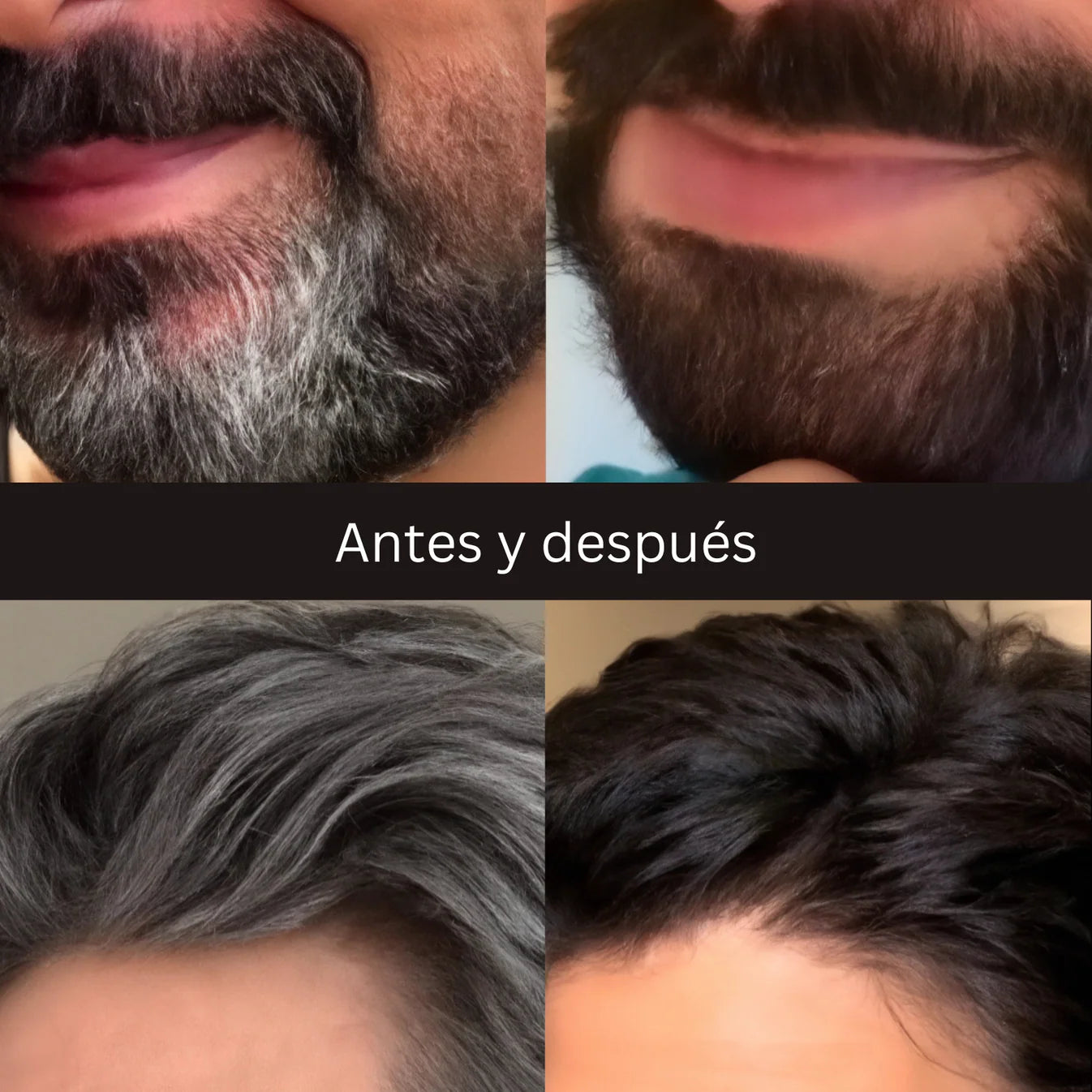 SHAMPOO ANTICANAS/ANTIEDAD CABELLO Y BARBA | 250ML