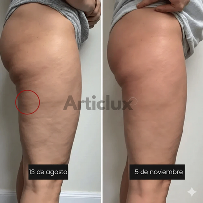 Legging Anticelulíticos - 2X1