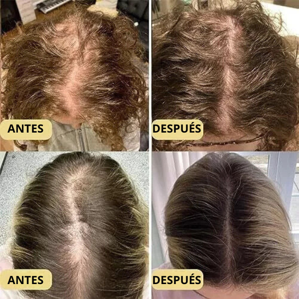 Aceite Natural Veganic - Para Crecimiento del Cabello