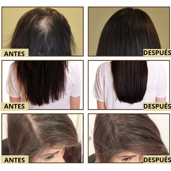 Aceite Natural Veganic - Para Crecimiento del Cabello